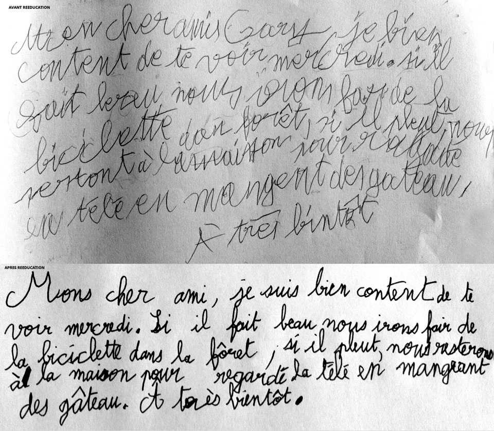 Page d'écriture, avant et après rééducation